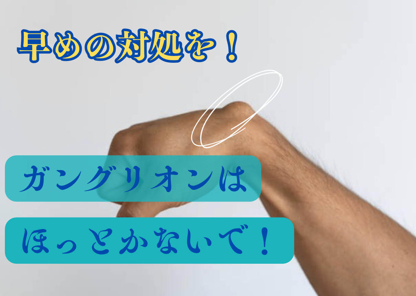 ガングリオン 痛い 時 対処 法