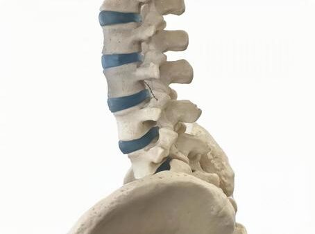 腰椎分離症とすべり症って？その違いって？