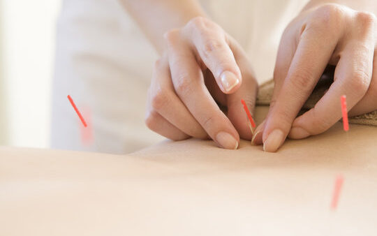 鍼施術を受ける前の知識に！鍼の独特な刺激「響き」を解説