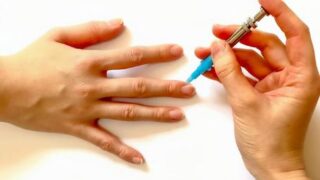 下肢静脈瘤の原因や症状。刺絡療法で期待できる効果を解説。