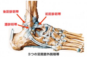 Ankle sprain